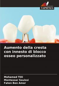 Produktbild: Aumento della cresta con innesto di blocco osseo personalizzato