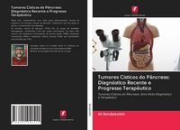 Produktbild: Tumores C&iacute;sticos do P&acirc;ncreas: Diagn&oacute;stico Recente e Progresso Terap&ecirc;utico