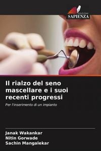 Produktbild: Il rialzo del seno mascellare e i suoi recenti progressi