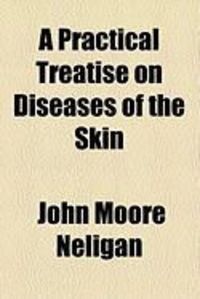 Produktbild: A Practical Treatise on Diseases of the Skin