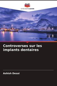 Produktbild: Controverses sur les implants dentaires