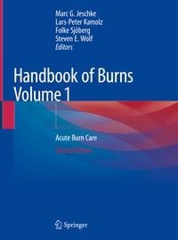 Produktbild: Handbook of Burns Volume 1
