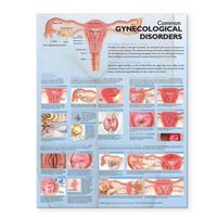 Produktbild: Tbd: Common Gynecological Disorders Paper Ch