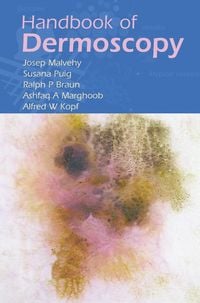 Produktbild: Handbook of Dermoscopy
