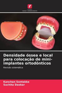 Produktbild: Densidade &oacute;ssea e local para coloca&ccedil;&atilde;o de mini-implantes ortod&ocirc;nticos
