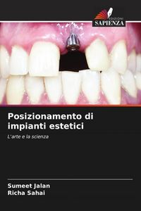 Produktbild: Posizionamento di impianti estetici