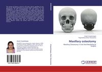 Produktbild: Maxillary osteotomy