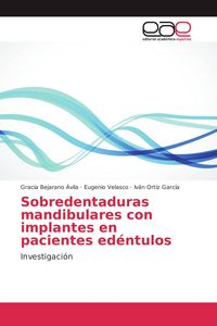 Produktbild: Sobredentaduras mandibulares con implantes en pacientes ed&eacute;ntulos
