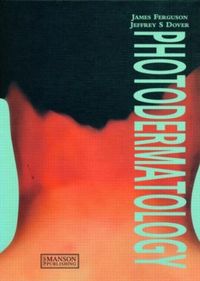 Produktbild: Ferguson, J: Photodermatology