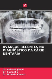 Produktbild: Avan&ccedil;os Recentes No Diagn&oacute;stico Da C&aacute;rie Dent&aacute;ria