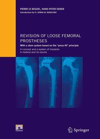 Produktbild: Revision of loose femoral prostheses with a stem system based on the "press-fit" principle