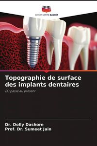Produktbild: Topographie de surface des implants dentaires