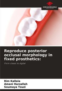 Produktbild: Reproduce posterior occlusal morphology in fixed prosthetics: