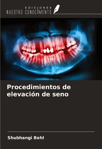 Produktbild: Procedimientos de elevaci&oacute;n de seno