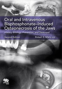 Bild vom Artikel Oral and Intravenous Bisphosphonate-Induced Osteonecrosis of the Jaws vom Autor Robert E. Marx