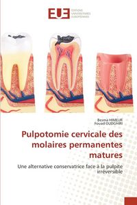 Produktbild: Pulpotomie cervicale des molaires permanentes matures