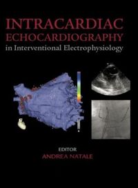 Produktbild: Intracardiac Echocardiography in Interventional Electrophysi
