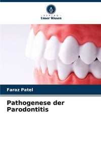Produktbild: Pathogenese der Parodontitis