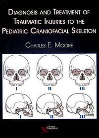 Produktbild: Diagnosis and Treatment of Traumatic Injuries to the Pediatric Craniofacial Skeleton