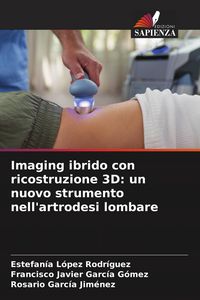 Produktbild: Imaging ibrido con ricostruzione 3D: un nuovo strumento nell'artrodesi lombare