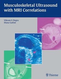 Produktbild: Musculoskeletal Ultrasound with MRI Correlations