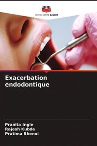 Produktbild: Exacerbation endodontique