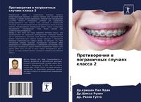 Produktbild: Protiworechiq w pogranichnyh sluchaqh klassa 2