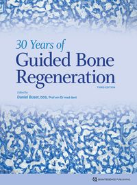 Bild vom Artikel 30 Years of Guided Bone Regeneration vom Autor Daniel Buser