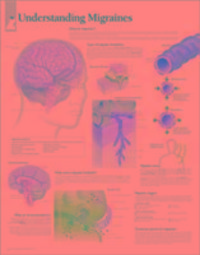 Produktbild: Publishing, S: Understanding Migraines Paper Poster