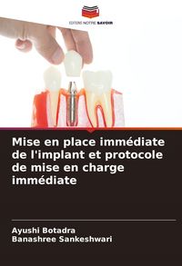 Produktbild: Mise en place imm&eacute;diate de l'implant et protocole de mise en charge imm&eacute;diate