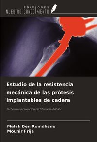 Produktbild: Estudio de la resistencia mec&aacute;nica de las pr&oacute;tesis implantables de cadera