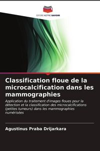 Produktbild: Classification floue de la microcalcification dans les mammographies
