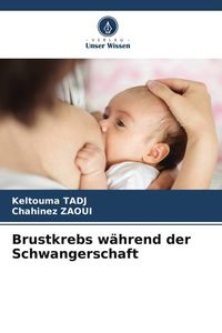 Produktbild: Brustkrebs w&auml;hrend der Schwangerschaft