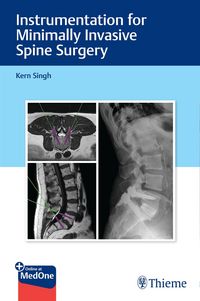 Produktbild: Instrumentation for Minimally Invasive Spine Surgery