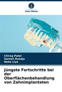 Produktbild: J&uuml;ngste Fortschritte bei der Oberfl&auml;chenbehandlung von Zahnimplantaten