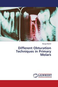 Produktbild: Different Obturation Techniques in Primary Molars