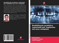 Produktbild: Reabilita&ccedil;&atilde;o prot&eacute;tica suportada por implantes em arco completo