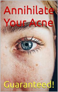 Produktbild: Annihilate Your Acne: How to Get Rid of Acne and Create Beautiful, Clear Skin; Your Easy, Proven Plan to Get Rid of Acne Fast