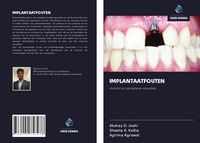 Produktbild: Implantaatfouten