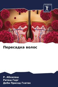 Produktbild: Peresadka wolos