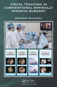 Produktbild: Visual Tracking in Conventional Minimally Invasive Surgery