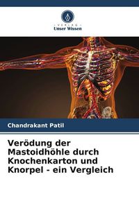 Produktbild: Ver&ouml;dung der Mastoidh&ouml;hle durch Knochenkarton und Knorpel - ein Vergleich