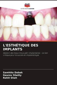 Produktbild: L'esth&eacute;tique des Implants