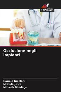 Produktbild: Occlusione negli impianti