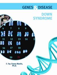 Produktbild: Evans-Martin, F: Down Syndrome