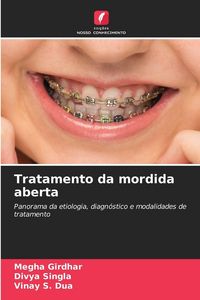 Produktbild: Tratamento da mordida aberta