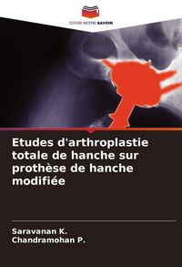 Produktbild: Etudes d'arthroplastie totale de hanche sur proth&egrave;se de hanche modifi&eacute;e
