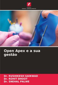 Produktbild: Open Apex e a sua gest&atilde;o