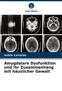 Produktbild: Amygdalare Dysfunktion und ihr Zusammenhang mit h&auml;uslicher Gewalt