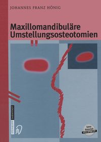 Bild vom Artikel Maxillomandibuläre Umstellungsosteotomien vom Autor Johannes-Franz Hönig